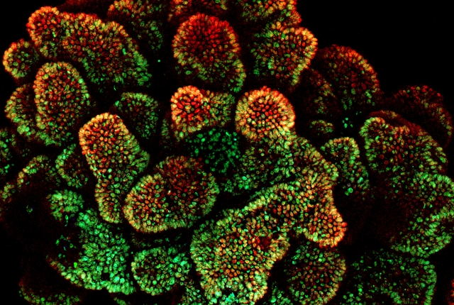 colon organoid projection image showing the epithelial cells in red at the points of the organoid, and the proliferating cells in green throughout the organoid