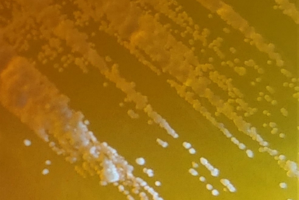 colonies of a fungus
