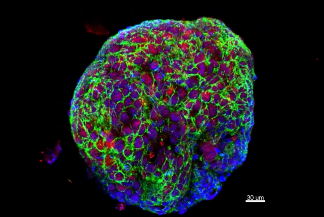 3D organoid