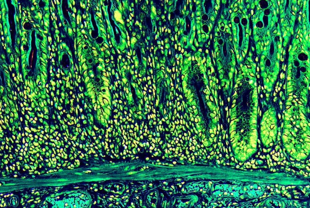 intestinal lining shown in neon greens