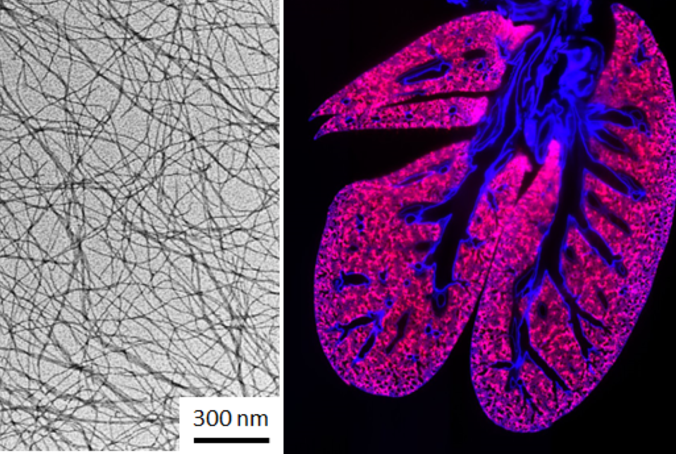 nanofibers targeting lung metastases