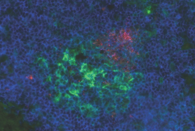 B cells shown in blue, in the center there is a large green section, the light zone, and above it a smaller red section, the dark zone