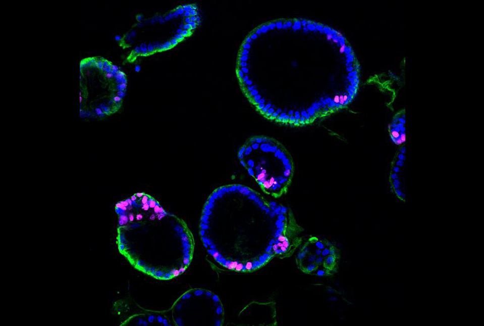 colonoic organoid