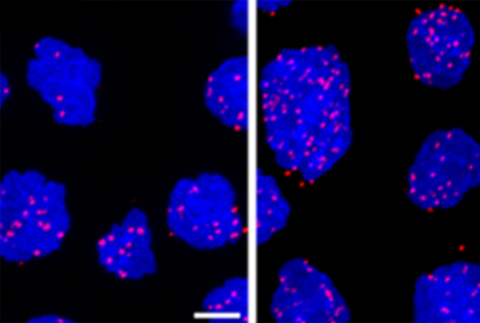 blue cells with pink dots