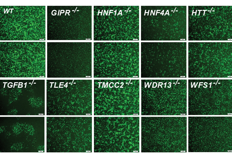 immunofluorescent image of differentiated pancreatic beta cells