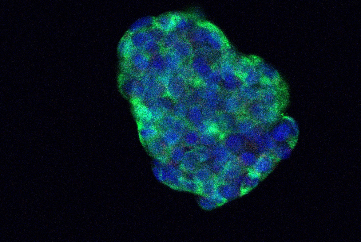 islet cell labeled with green for insulin and blue for nucleus