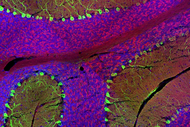 brain slice showing Glut4 in all of the main brain layers of the cerebellum