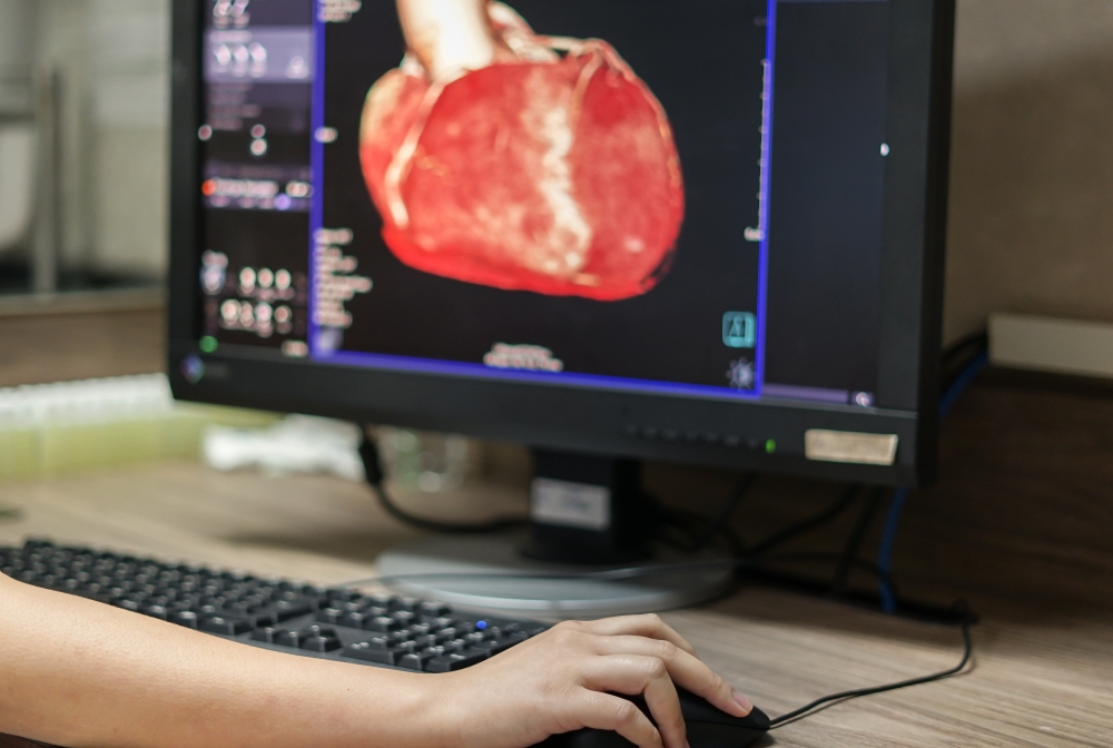 computer screen showing CT angiography