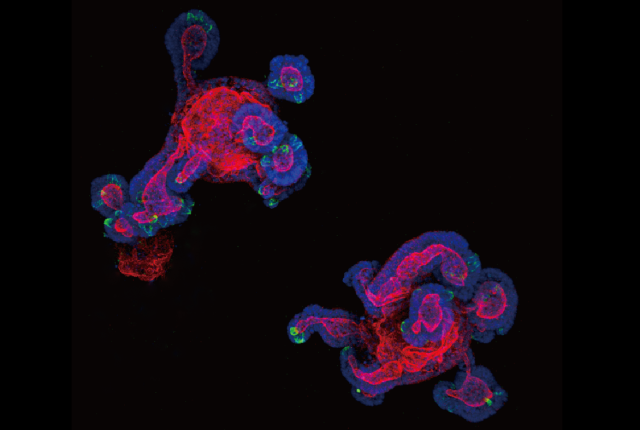 mouse intestinal organoids