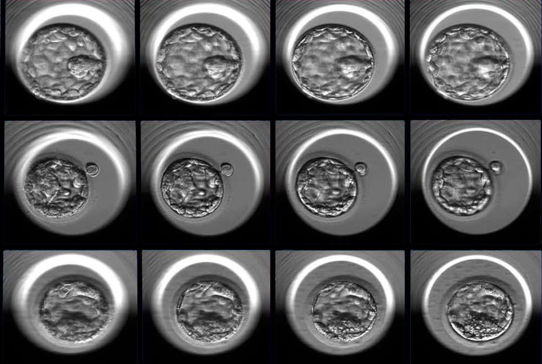 3 examples of human embryos at the blastocyst stage photographed at multiple focal depths 