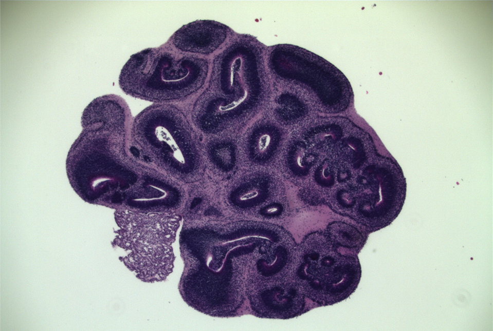 image of a cerebral brain organoid