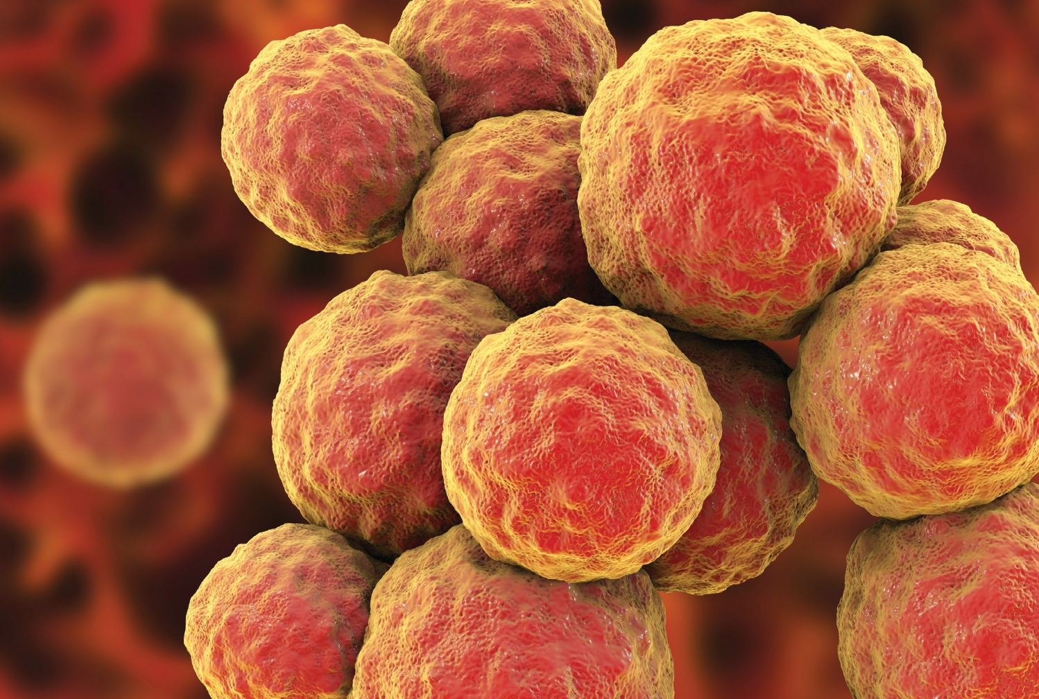 methicillin-resistant Staphylococcus aureus (MRSA) illustration