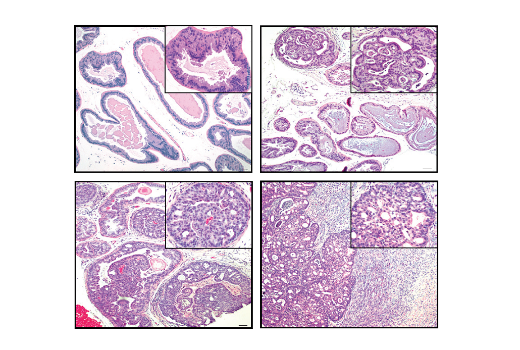 prostate tumor cells from mice models