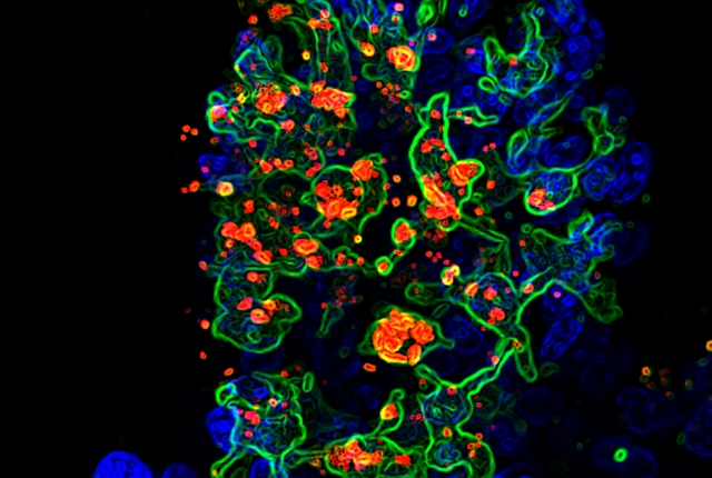 Opportunistic fungus Candida albicans shown in red engulfed by CX3CR1+ phagocytes shown in green in the gut villi shown in blue
