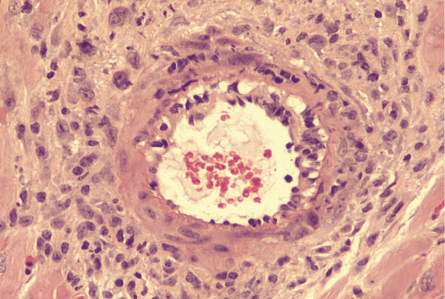 section of transplanted heart in mouse