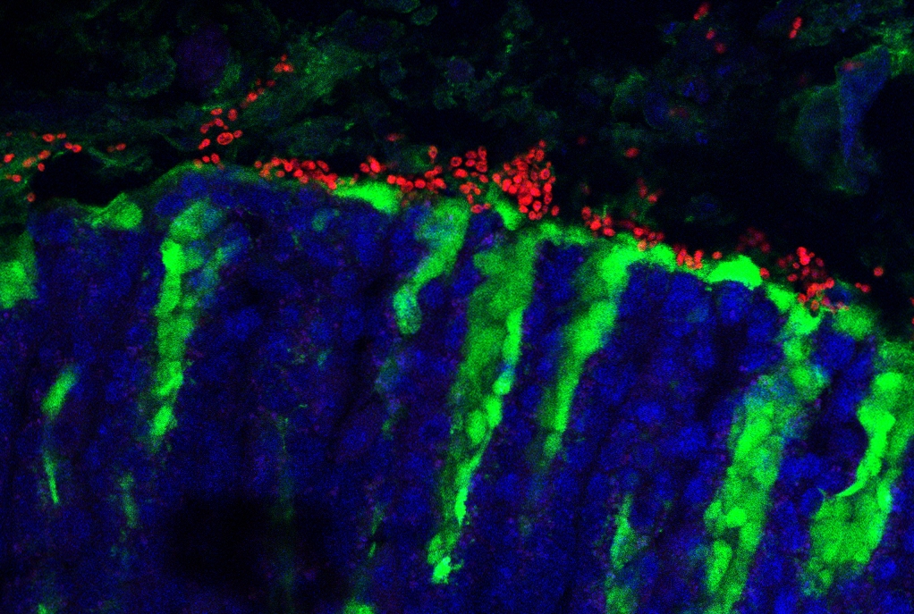 immunofluorescence image of mouse stomach with fungus stained red