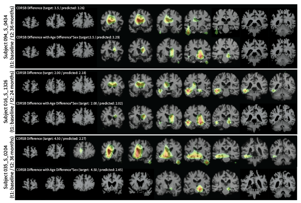 brain scans