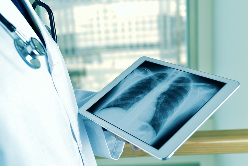 Radiologist examining a chest X-ray of a patient.