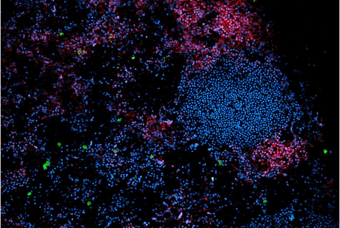 human immune cells in lymph node tissue