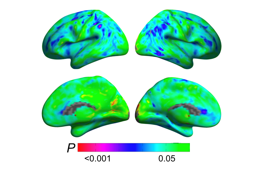 brain regions showing menopause transition
