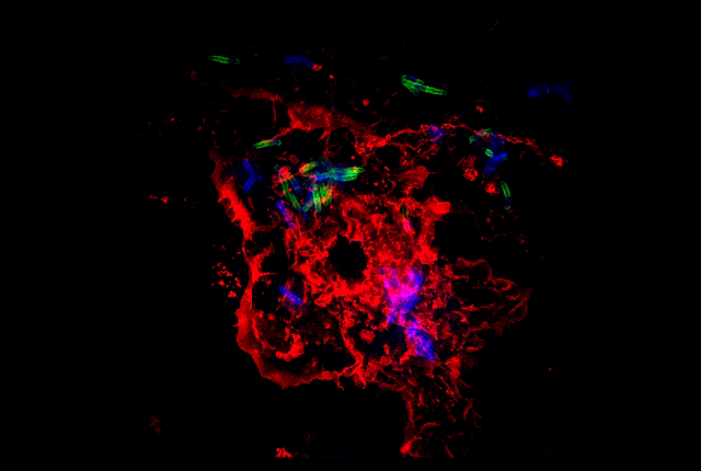 a macrophage, shown in red, infected with Mycobacterium tuberculosis, shown as small green and blue lines