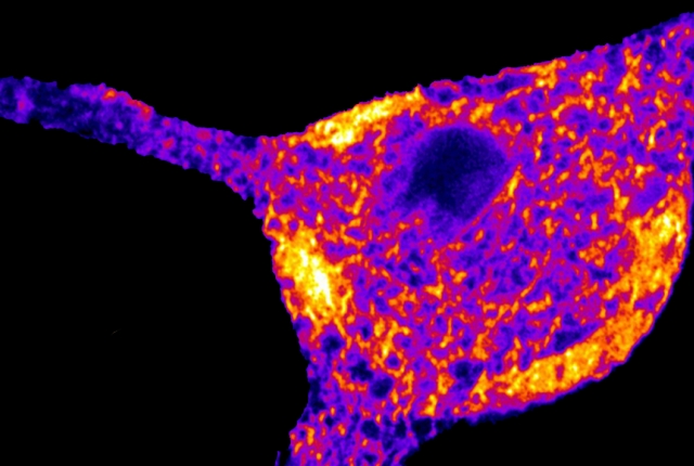 endoplasmic reticulum in rat neuron shown in neon purple, red and yellow