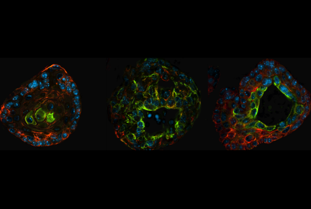 prostate organoids from genetically engineered mice