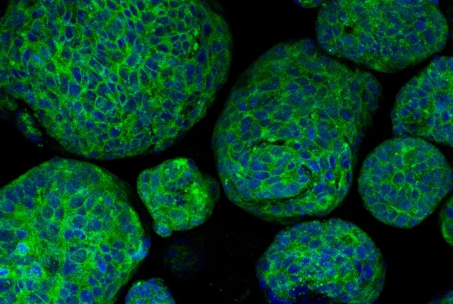prostate cancer organoids, stained green