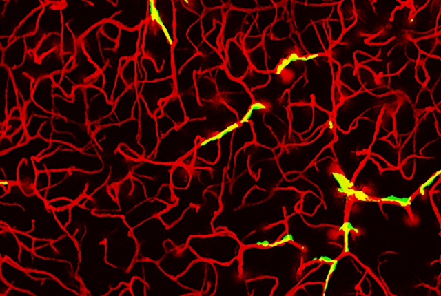 red blood vessels in the brain, a few places are highlighted in green, where perivascular macrophages are in close contact with the vessels