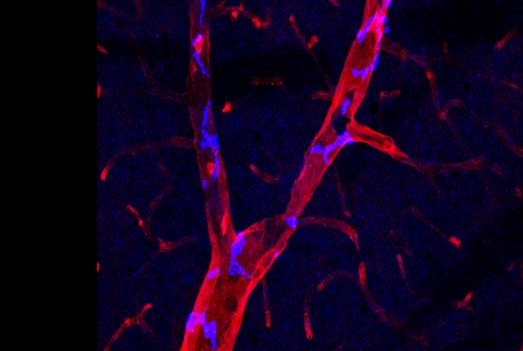 Brain perivascular macrophages