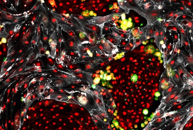 reprogrammed hematopoietic stem cells are green circles near gray vascular niche cells