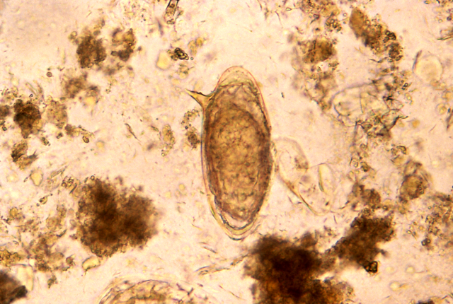 Schistosoma mansoni microscopic image