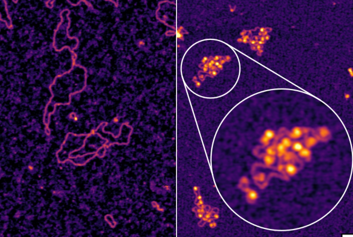 Atomic force microscopy images of hepatitis B DNA