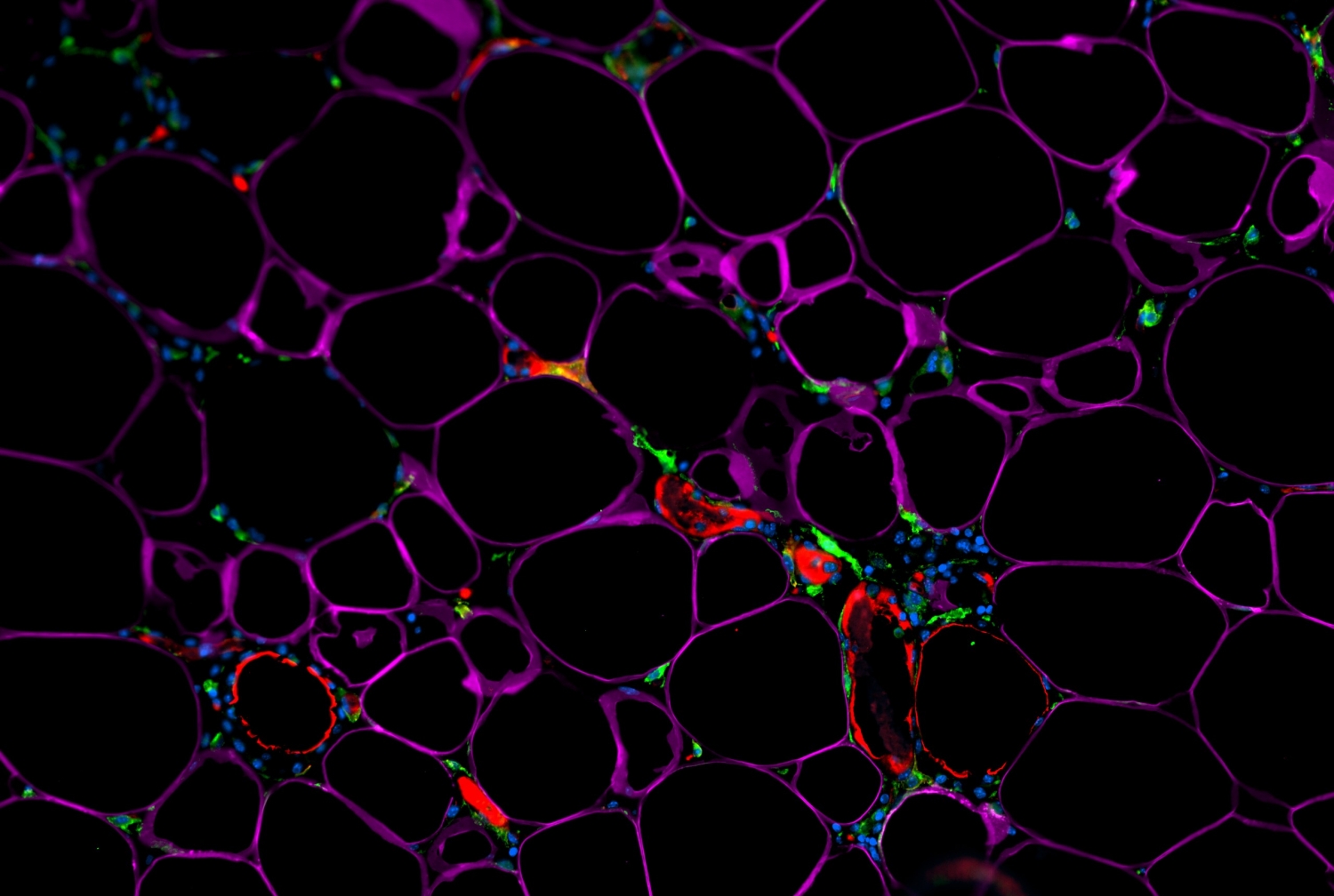 visualization of immune responses in the white adipose tissue, small sections highlighted in green are cytokine interleukin-33