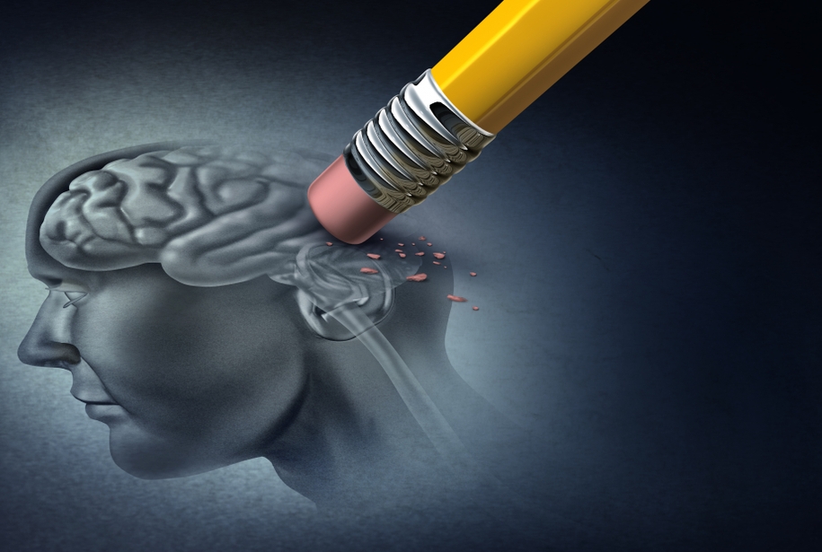 memory loss concept