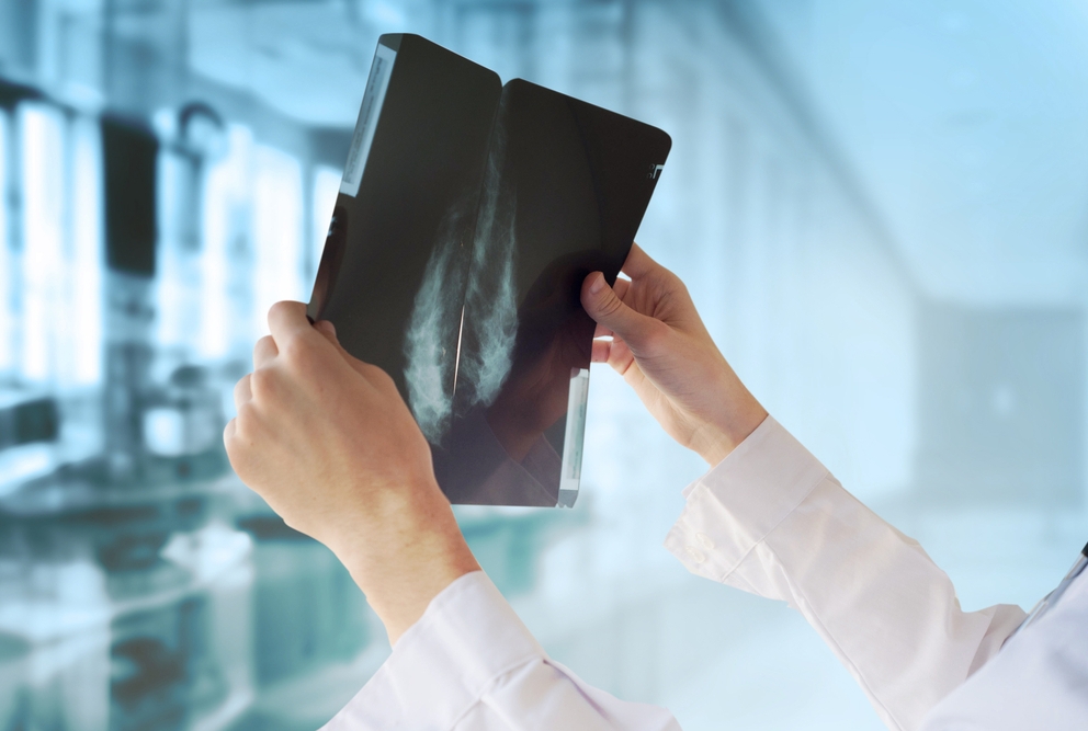 someone holding an x-ray