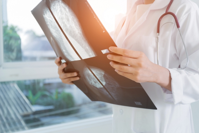 doctor holding a mammogram