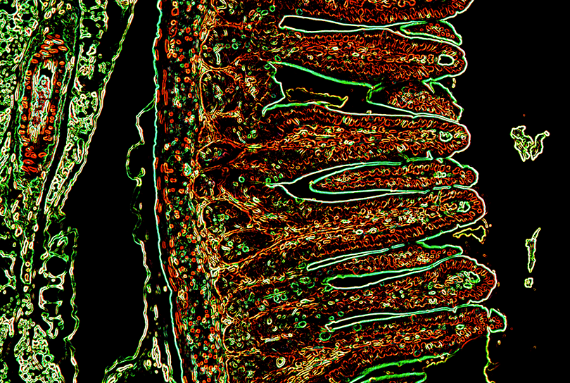 healthy small intestine where immune cells and epithelial cells are highlighted in green and red