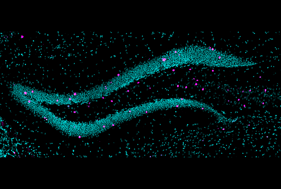activated neurons in the hippocampus