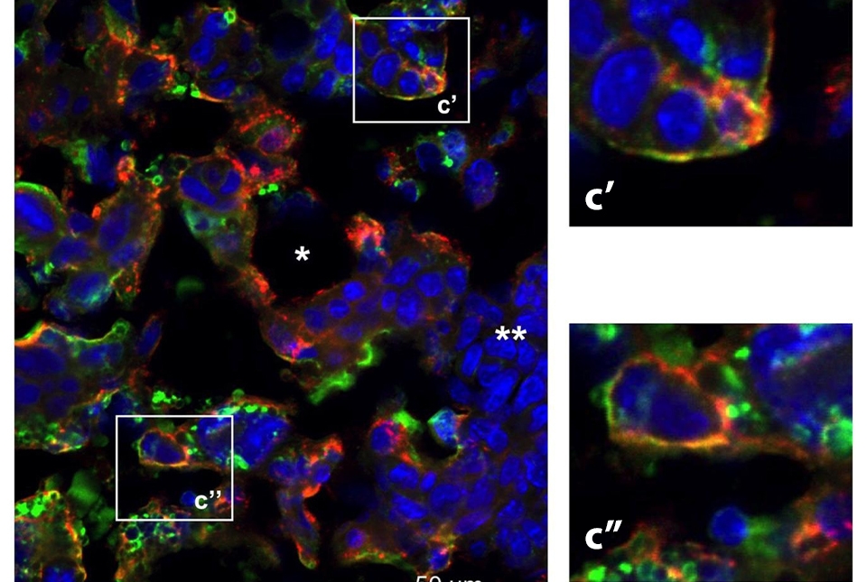 cytokines acting as pregnancy hormones