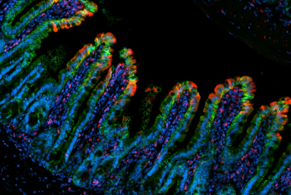 microscopic gut cells