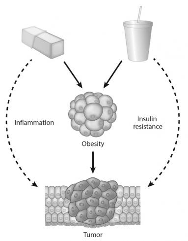  An illustration of how fatty and sugary foods, such as butter and soda, can fuel obesity, inflammation and insulin resistance—potentially feeding cancers