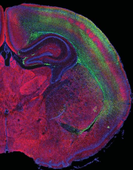  The cerebral cortex’s receptive areas for the sense of touch (depicted in red) are seen surrounded by neural cell projections (green).