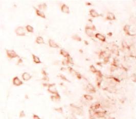 Tau accumulation in neurons of mice fed a high salt diet