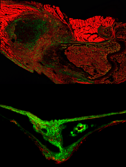  That same type of cell as seen in the skull of a 15-day-old mouse.
