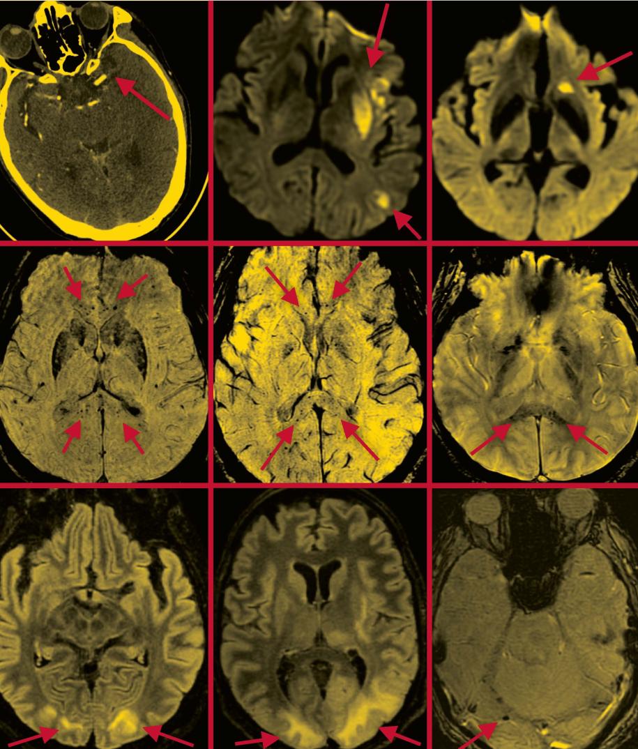 brain scans