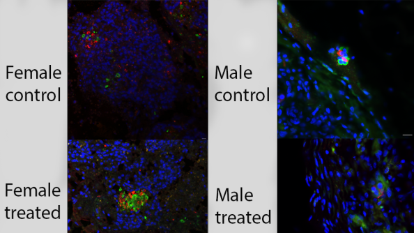 Immunofluorescent image of cells tagged with red, green and blue labels