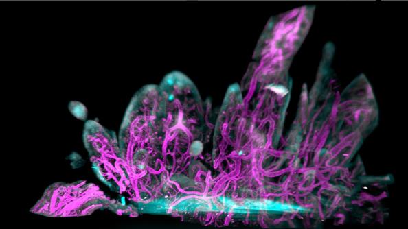 magenta and cyan stained tissue