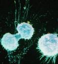 blue spherical objects against a black backdrop