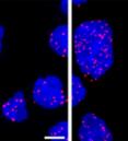 blue cells with pink dots